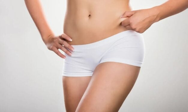 The Lower Body Lift Treats Loose Skin All the Way Around